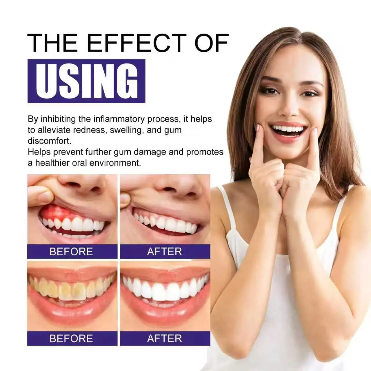 Starlite Smile Red Light Therapy Device, Gum Disease & Periodontal Treatment for Oral Care, Promotes Healing and Pain Relief