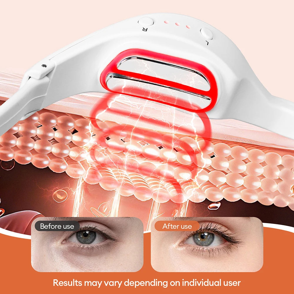 3D Eyes Relax Massager, Red Light, Fine Line Relax Massager for Dark Circles