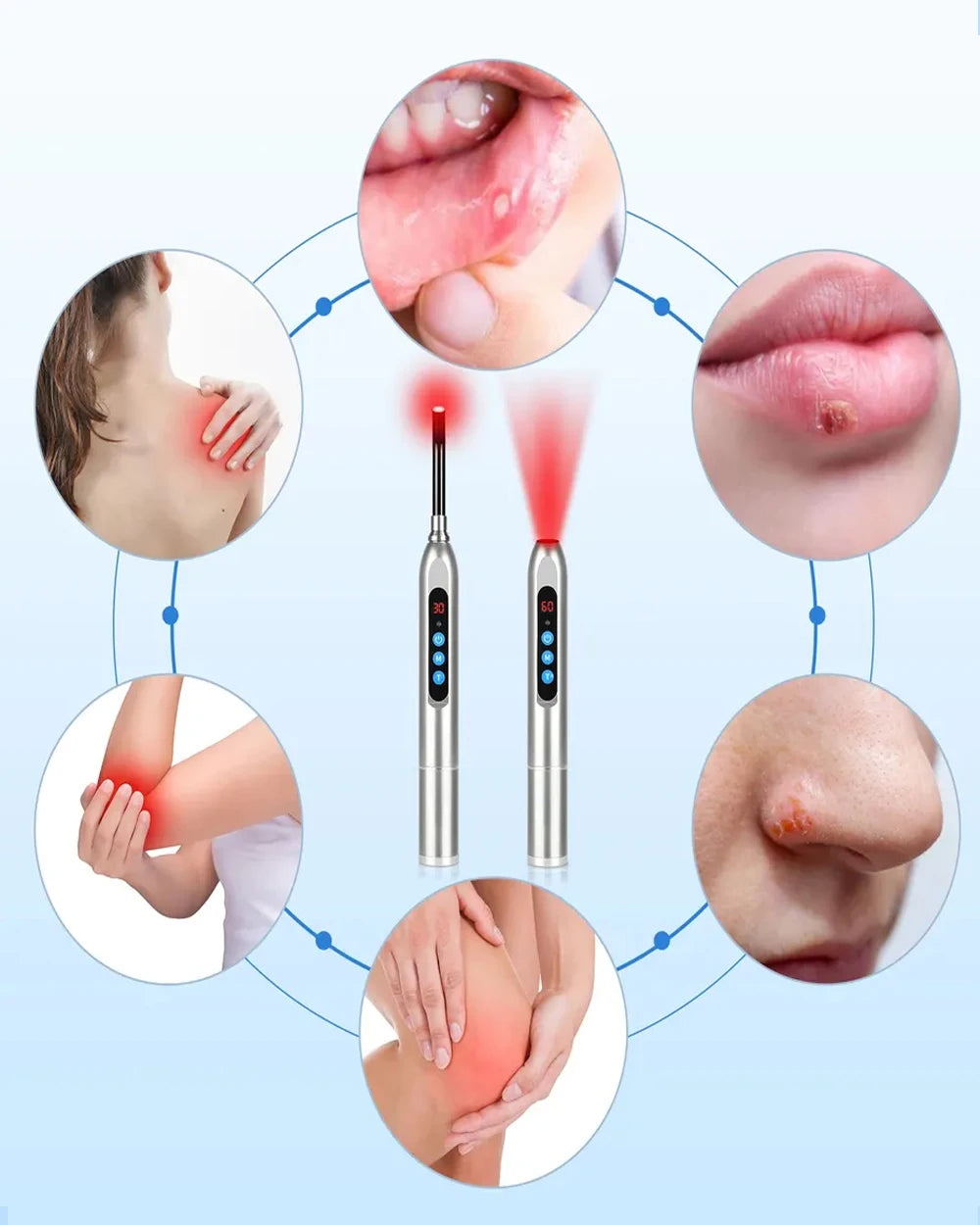 Therapy Cold Sore Wand, Device For Mouth Sores Treatment, LED Light Therapy Machine Skin Care