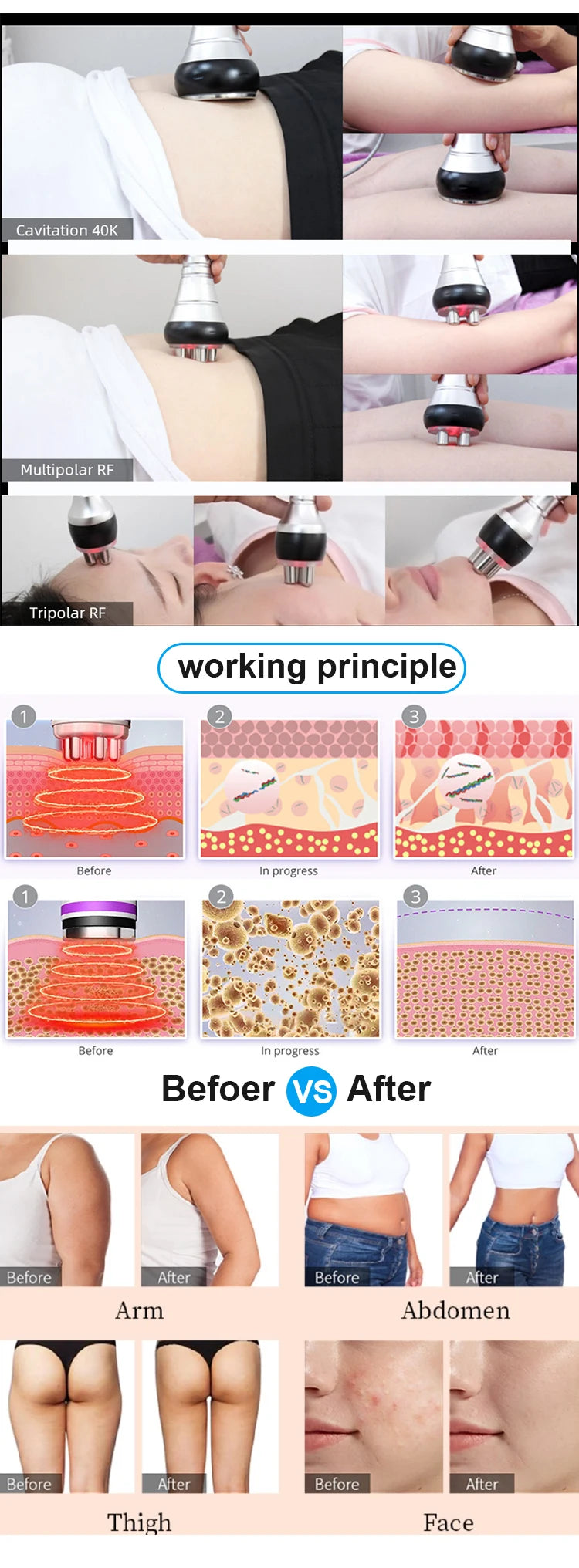 Beauty Body Slimming Massager, Cavitation Machine, Multi-Functional Device, Face Body Tightening, Lifting Spa Skincare Tool