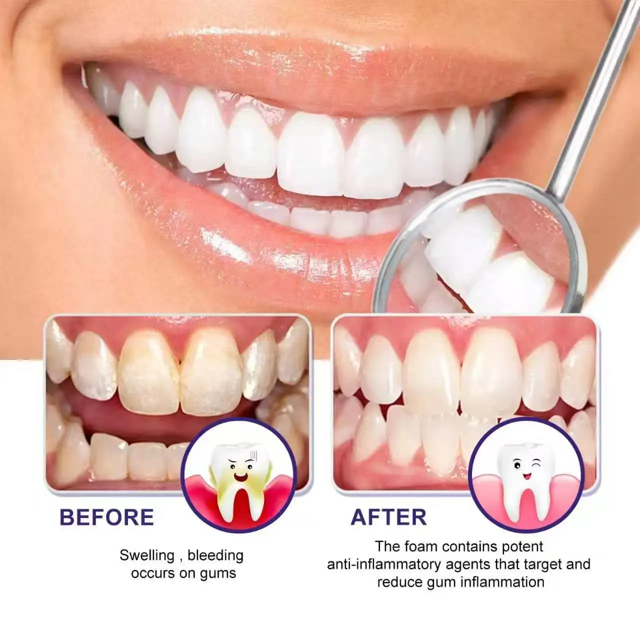 Starlite Smile Red Light Therapy Device, Gum Disease & Periodontal Treatment for Oral Care, Promotes Healing and Pain Relief