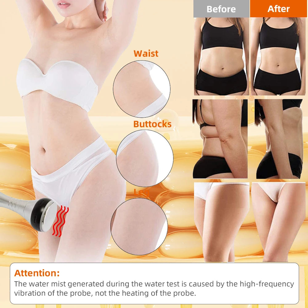 Cavitation Machine, 40k Ultrasonic, Shape Vacuum, Frequency Liposuction, Weight Loss, tightening and slimming device
