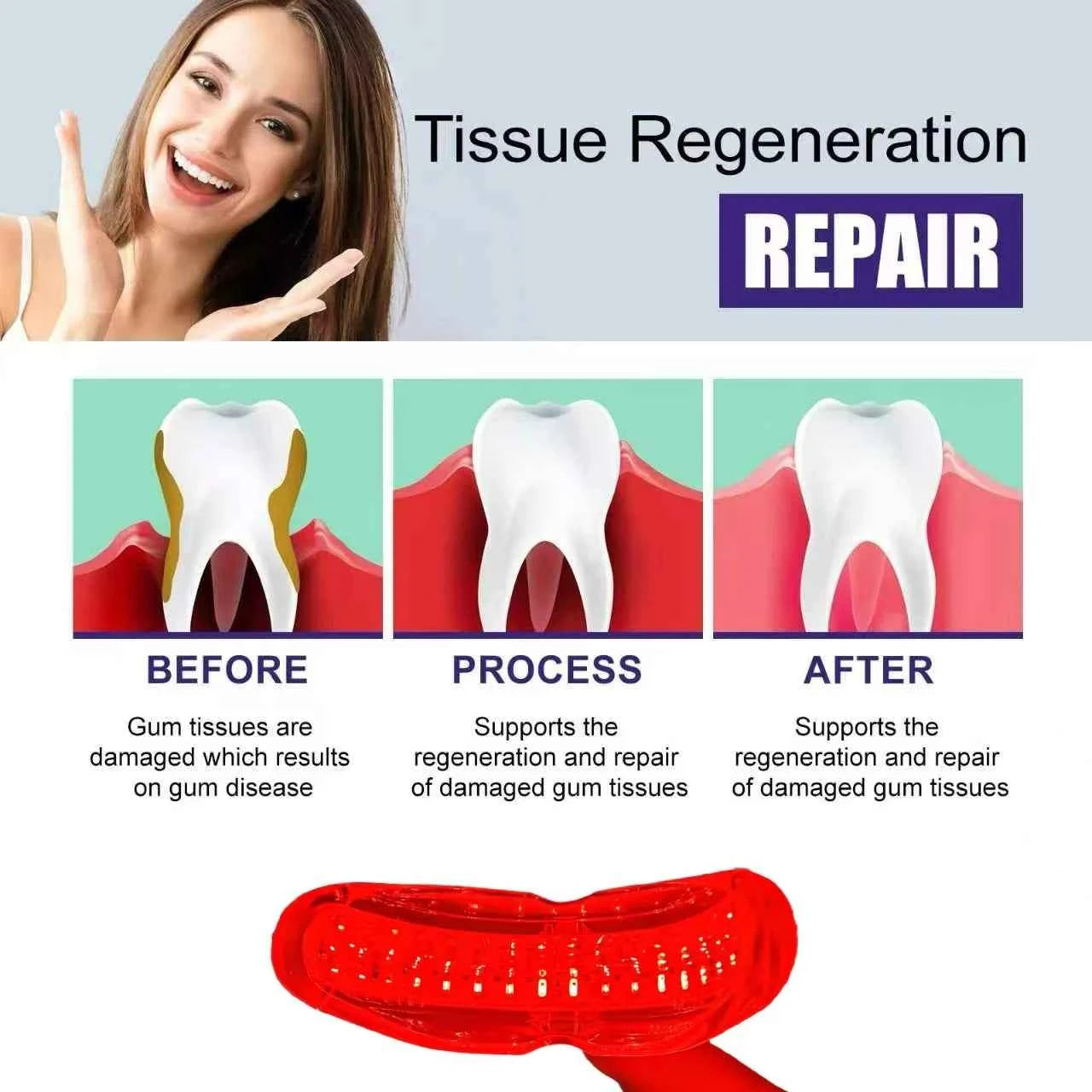 Starlite Smile Red Light Therapy Device, Gum Disease & Periodontal Treatment for Oral Care, Promotes Healing and Pain Relief