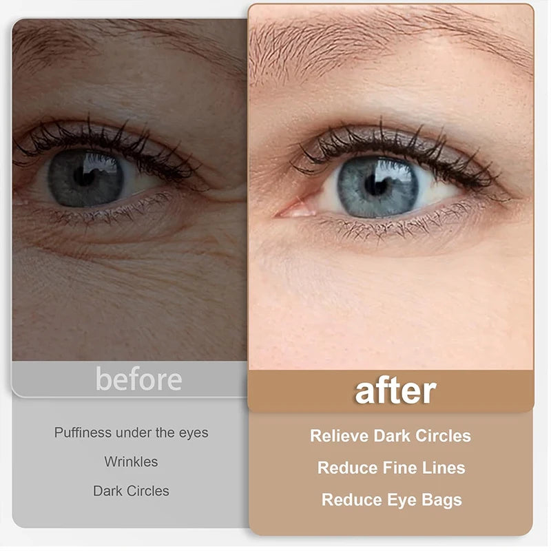 EMS Pulse Micro current, Relieve Fatigue, Reduce Dark Circles, Lines, Swelling, Anti-Wrinkle