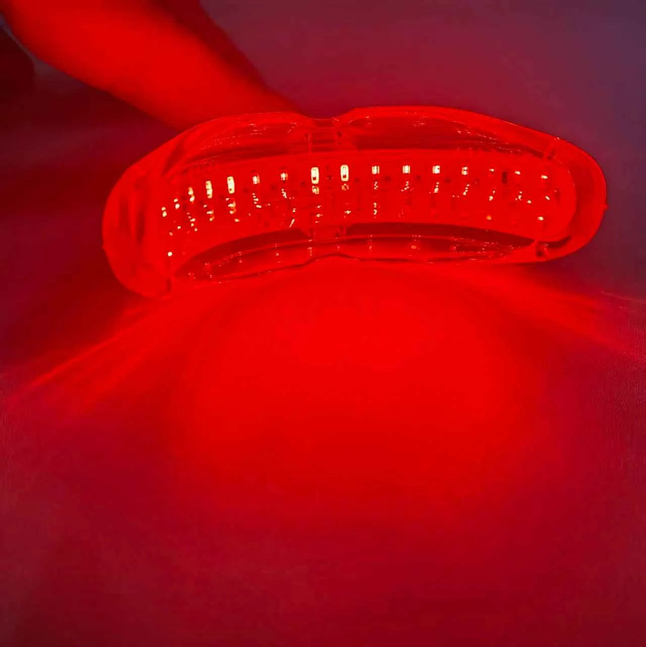 Starlite Smile Red Light Therapy Device, Gum Disease & Periodontal Treatment for Oral Care, Promotes Healing and Pain Relief