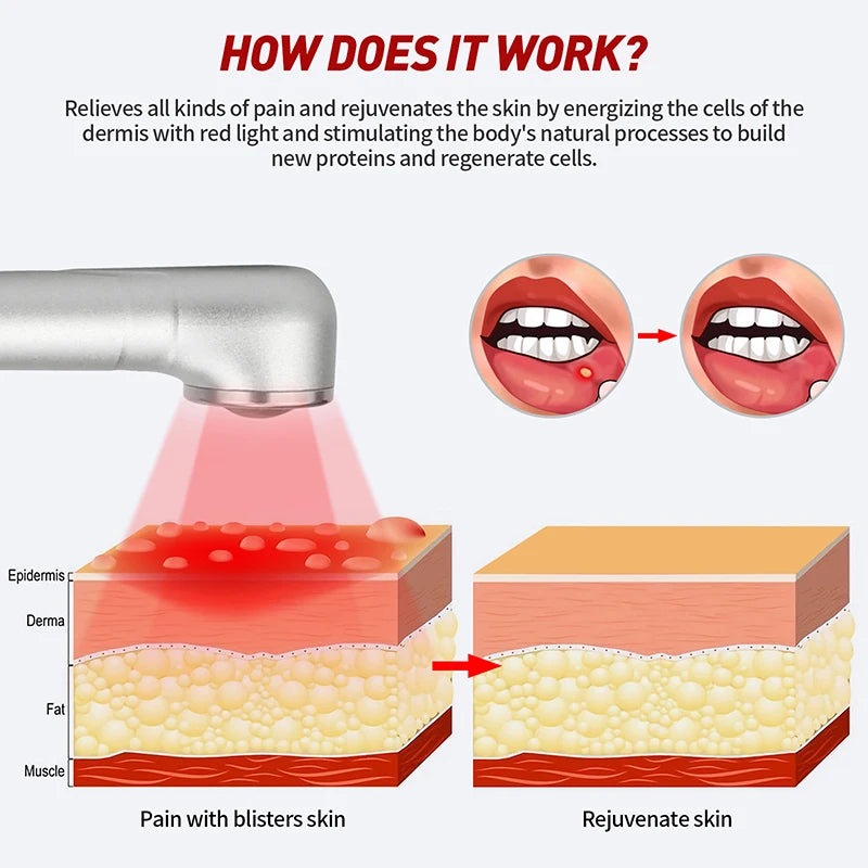 Therapy Cold Sore Wand, Device For Mouth Sores Treatment, LED Light Therapy Machine Skin Care
