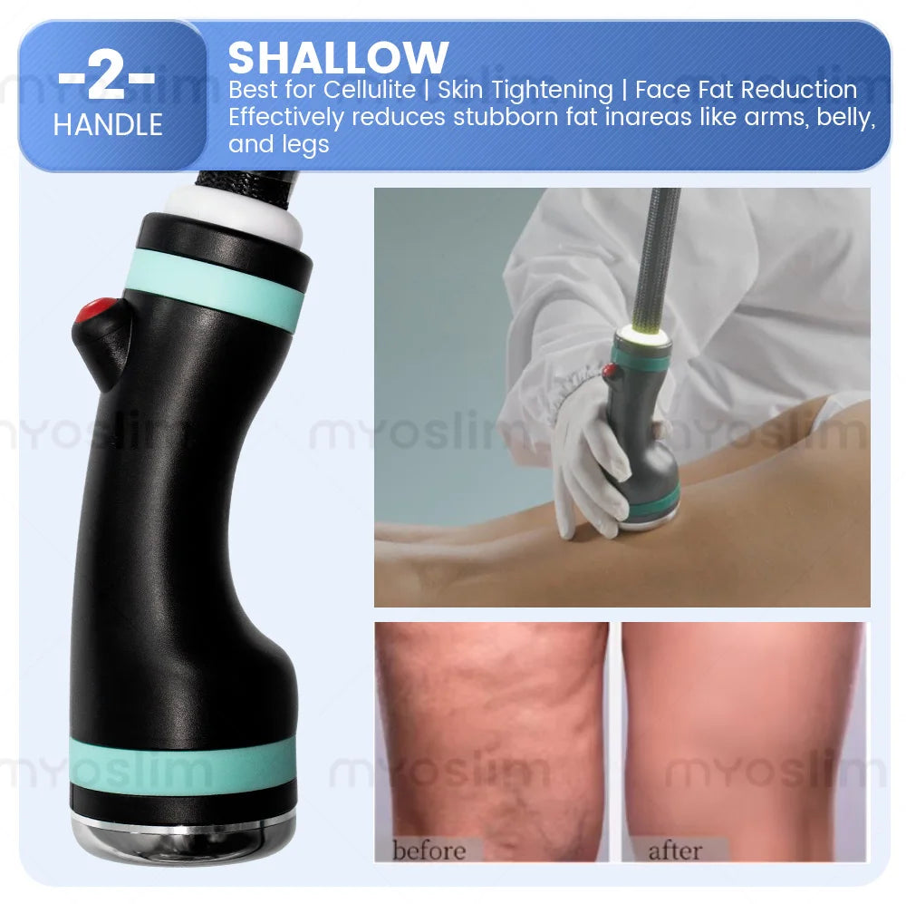 New Pro 3 Handles, Micro Wave 80% Fat Reduction, Safe Weight Loss, Eliminate Double Chin Removal