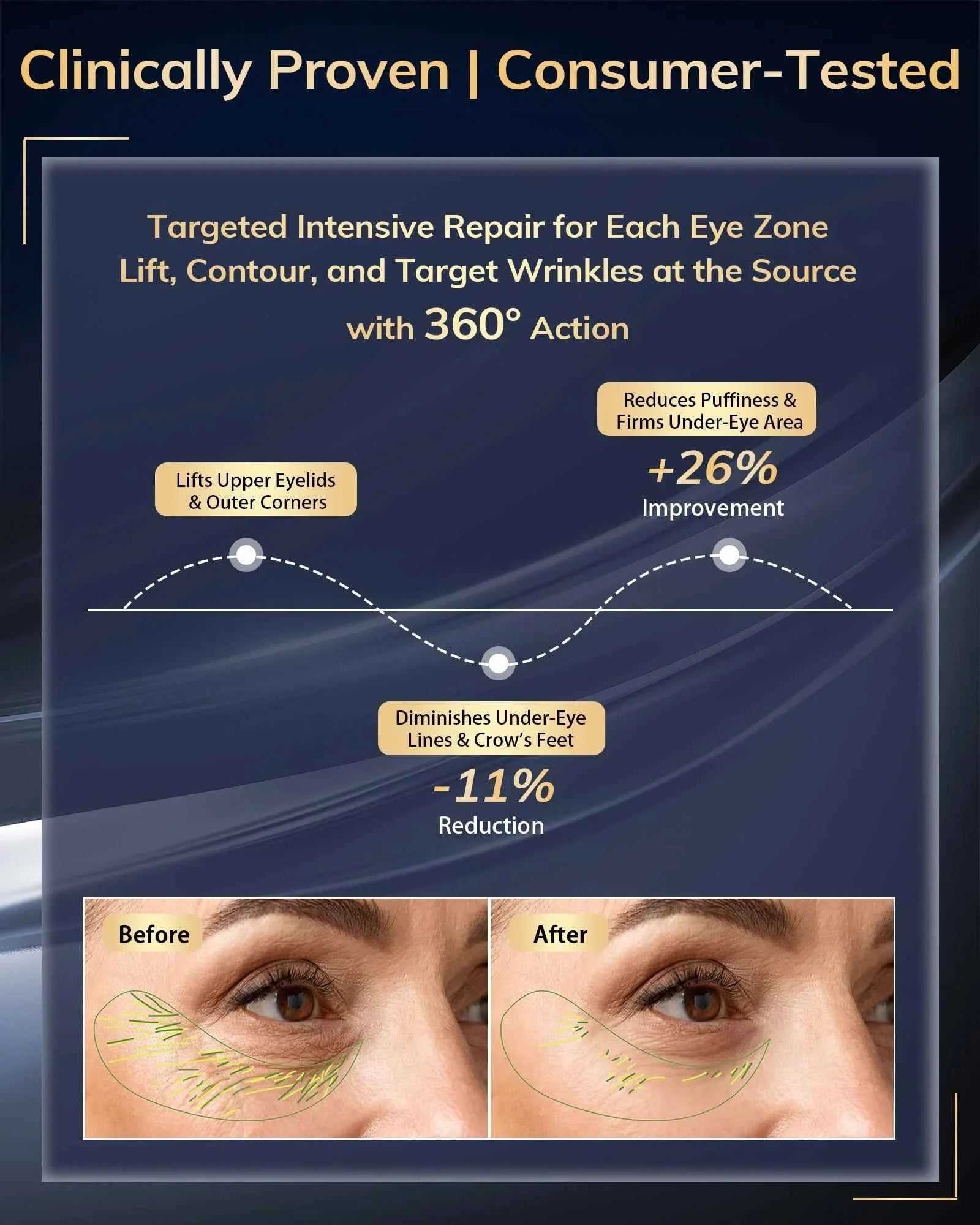 3D Eye Massager 630nm, Red Light Therapy Device, Treatment of Eye Bags & Dark Circles & Puffiness