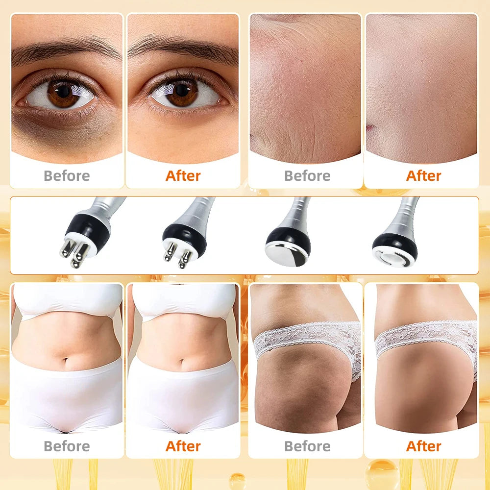 Cavitation Machine, 40k Ultrasonic, Shape Vacuum, Frequency Liposuction, Weight Loss, tightening and slimming device