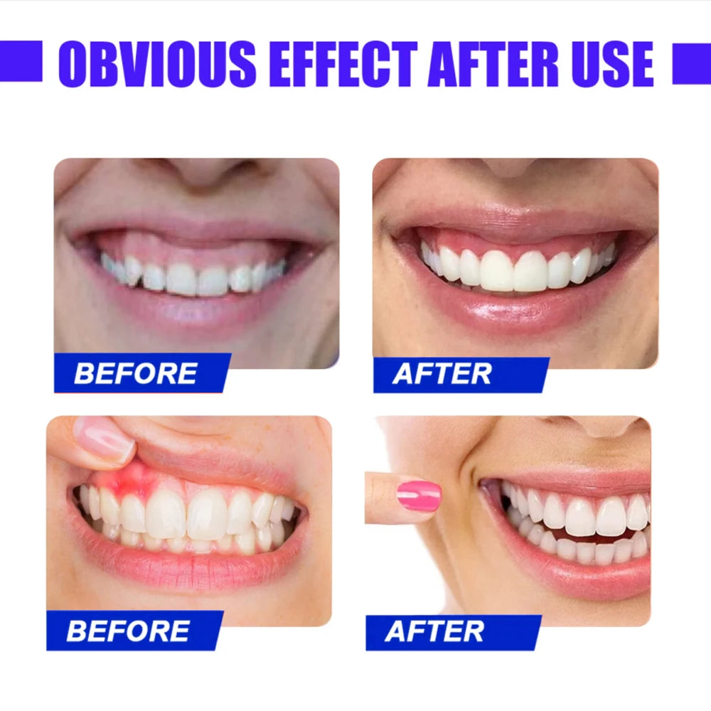 Tooth and Gum, Red Light Therapy for Immediate Relief